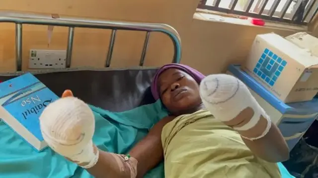 Man allegedly cuts off his wifes hand in enugu